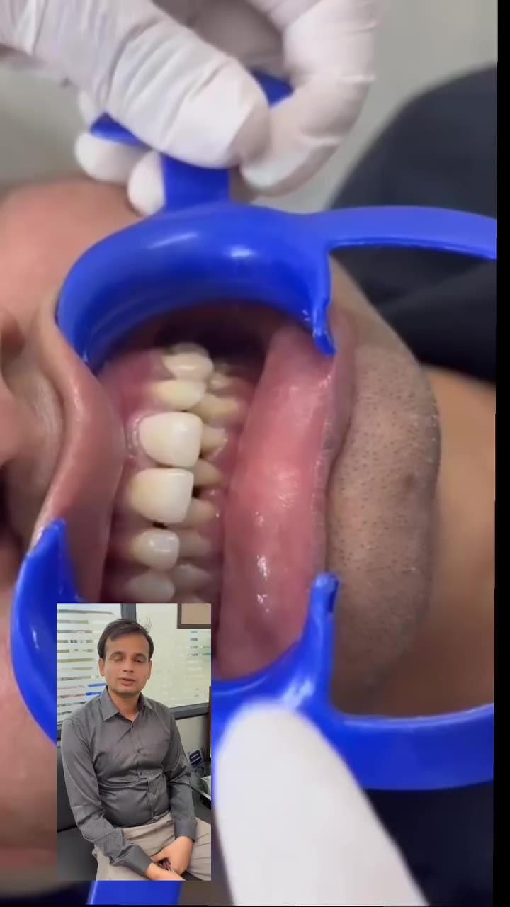 Patient testimonial 3